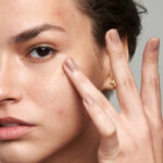 maskne-granitos-por-mascarilla