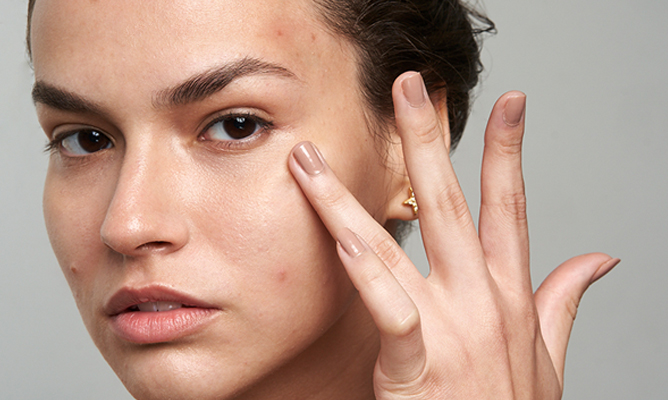 Maskne: como eliminar las espinillas y granos de la cara por el uso de mascarillas